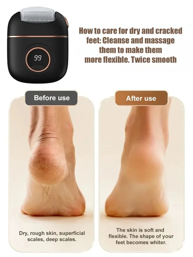 🔥2025🔥 New digital electric foot polishing machine
