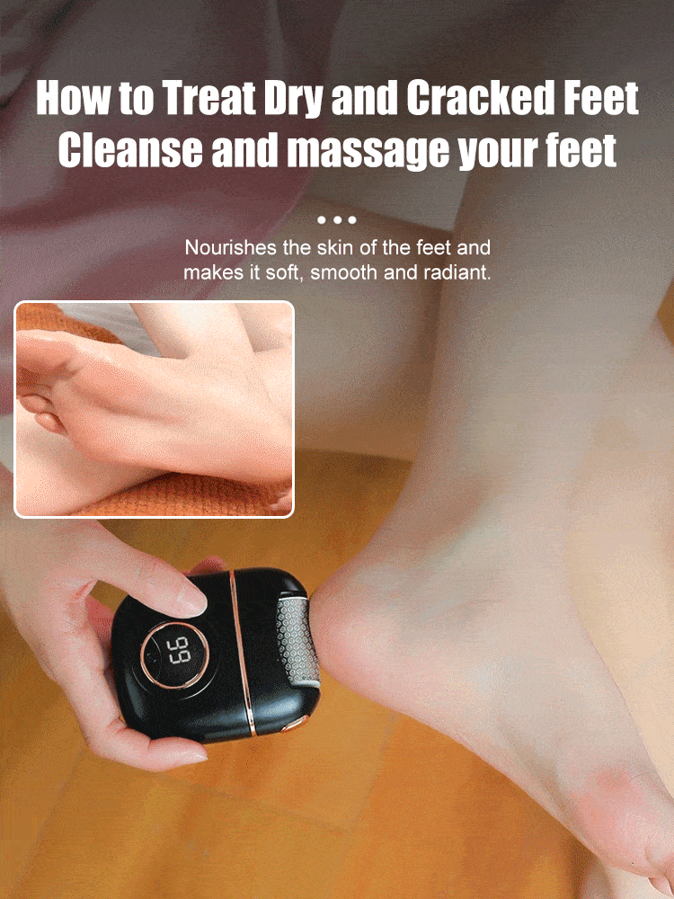 🔥2025🔥 New digital electric foot polishing machine