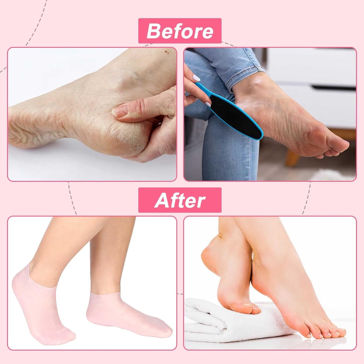 🥳2026 HOT SALE🥳💞50K+ SOLD!🦶✨ 50% OFF! Moisturizing Foot Mask Socks – Silicone gel locks in moisture, releases plant oils. Softens cracks & rough skin – wear with shoes for all‑day care! 🌿🧦