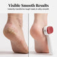📢📢50% OFF & Buy2 Get 1 Free⏰Double-Sided Foot Scraper for Callus Removal