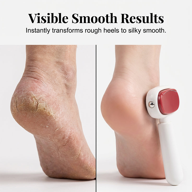 📢📢50% OFF & Buy2 Get 1 Free⏰Double-Sided Foot Scraper for Callus Removal